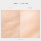 Tono e compattezza prima e dopo - immagine illustrativa
